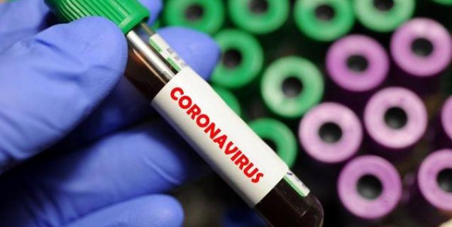 




Оперативна інформація про поширення коронавірусної інфекції COVID-19


