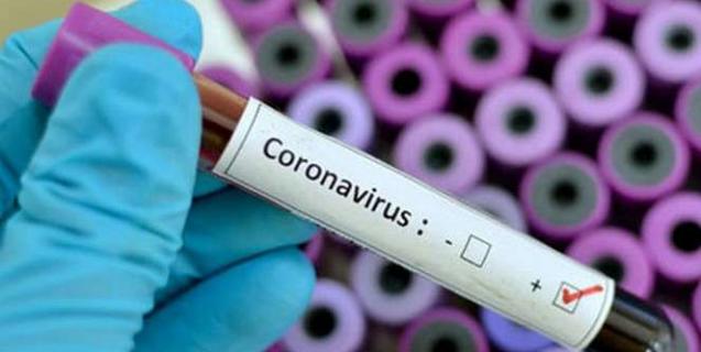 




105 черкащан захворіли на коронавірус


